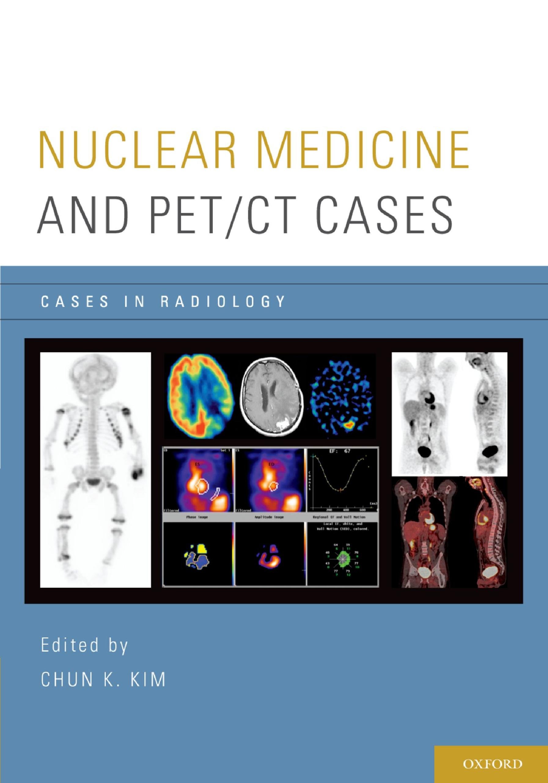 Nuclear Medicine and PET/CT Cases (Cases in Radiology) (English Edition)
