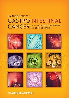 Handbook of Gastrointestinal Cancer book cover
