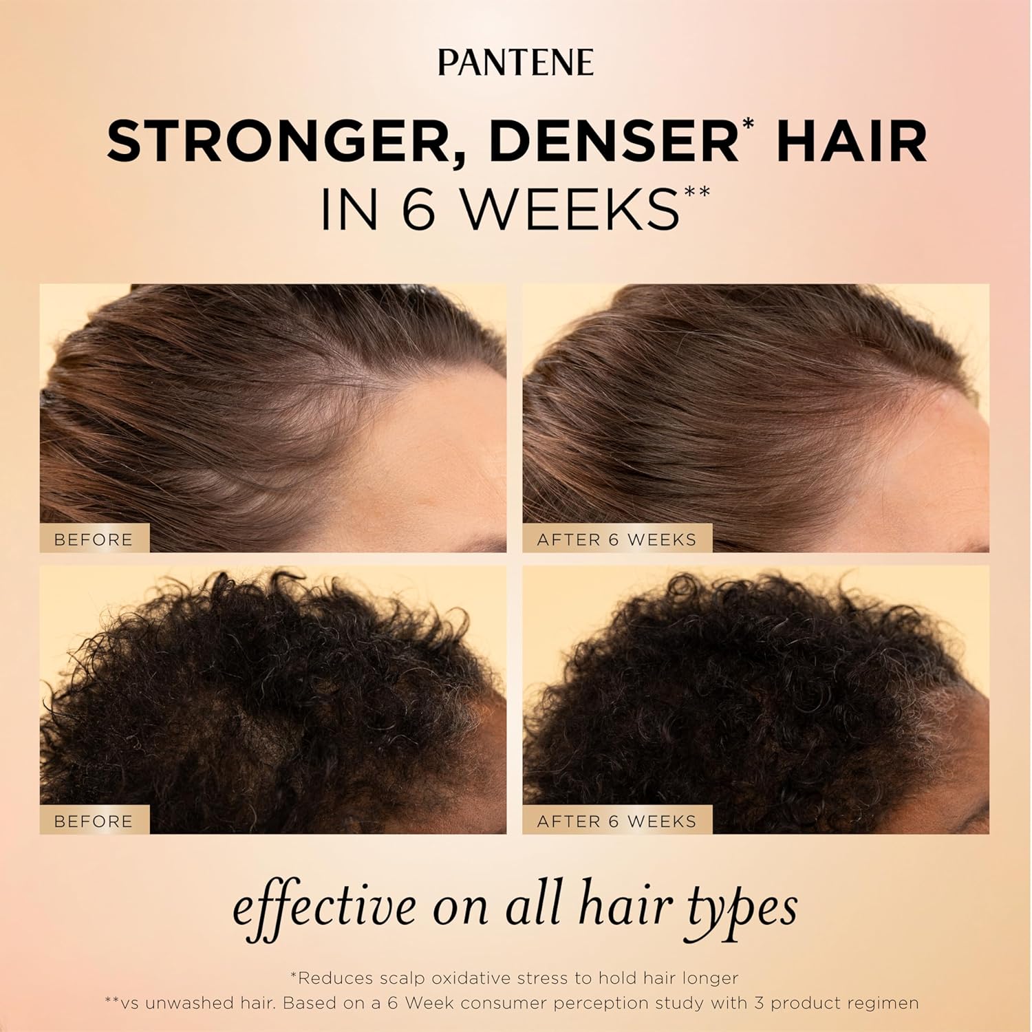 Pantene Abundant & Strong 3-Piece Regimen with B5 Complex + Niacinamide, Shampoo (13.5 oz), Conditioner (8 oz), Serum (2 oz) for Hair Loss, Thinning, Anti-Breakage, Volume - Grows Healthier - Image 4