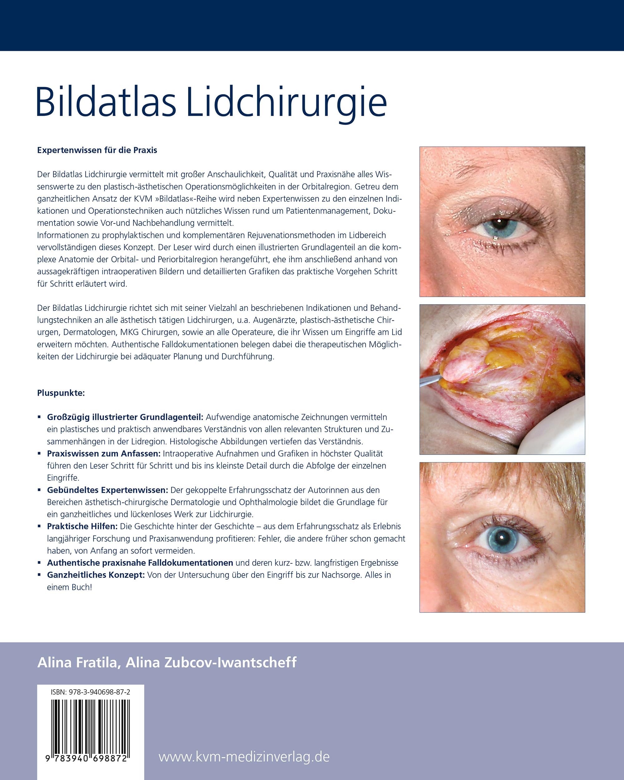 Bildatlas Lidchirurgie: Angewandte Anatomie | Untersuchung | Plastische Lidchirurgie