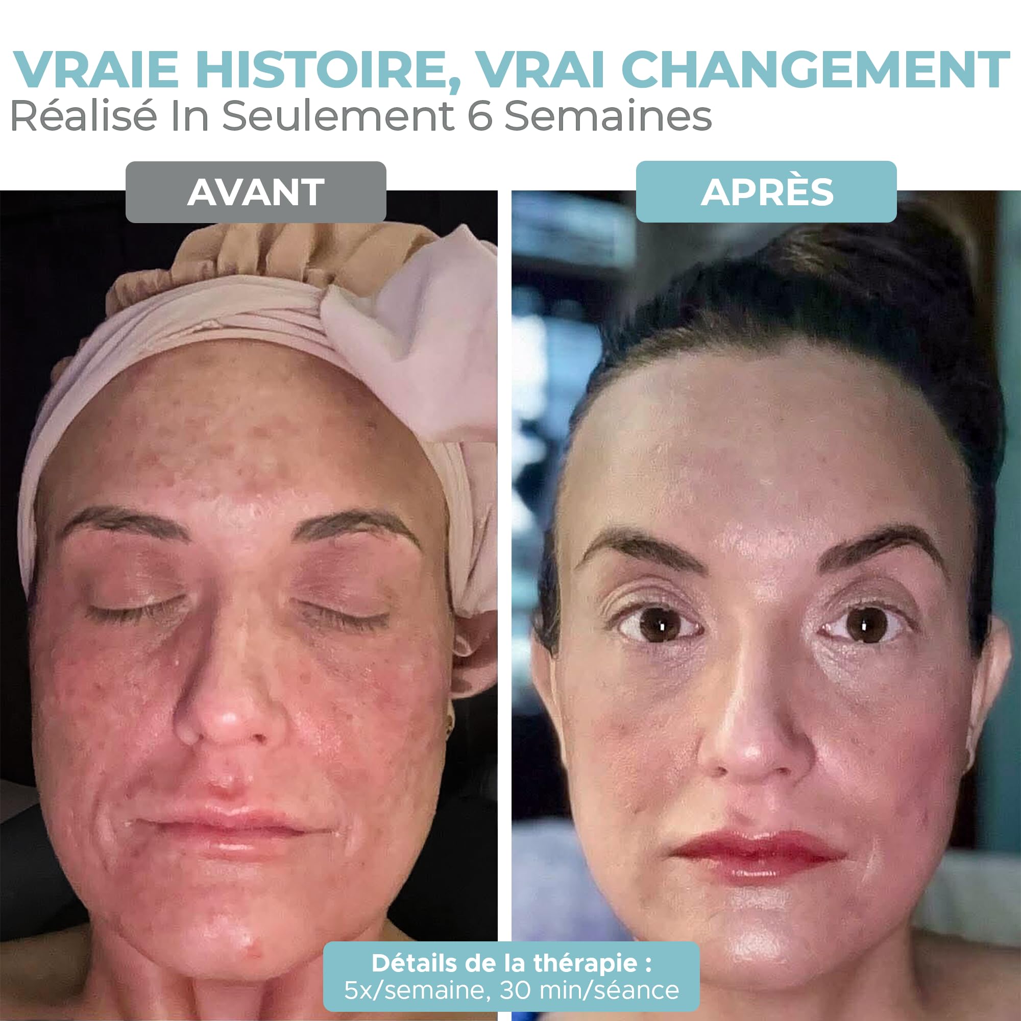 Nourished Bodynskin Masque Visage et Cou de Luminothérapie LED - Appareil de Soin de la Peau du Visage - 7 Couleurs Rouge et Bleu - Rajeunissement, Produit Anti-âge pour les Rides.
