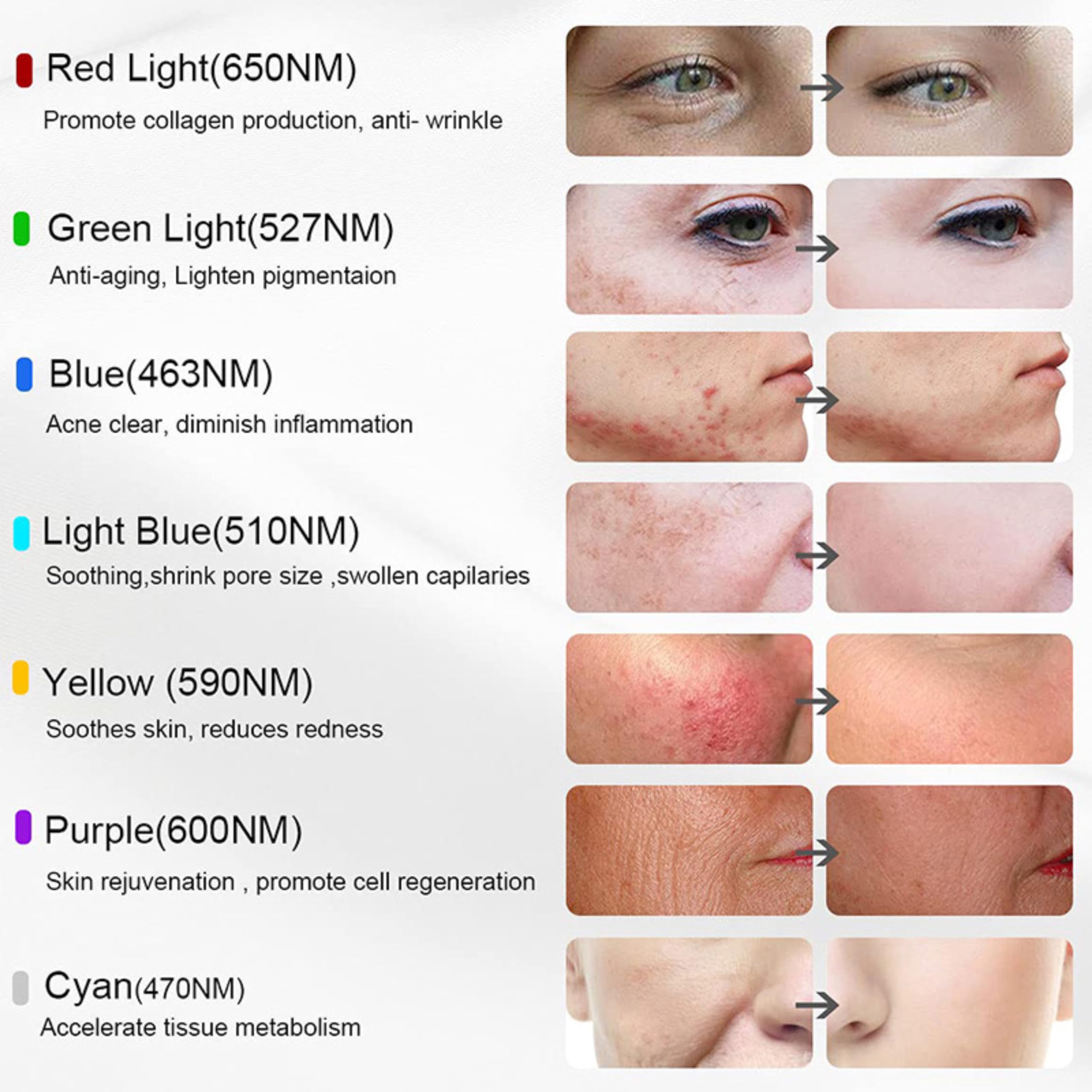 Lalano'S Cosmetics maska na twarz LED, 7 kolorów, przeciwstarzeniowa, trądzikowa i ujędrniająca skórę, terapia światłem, 112 diod LED, możliwość ponownego ładowania, certyfikat CE, dla kobiet i