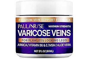 Varicose Veins Be Gone - Superior Legs Blood Circulation Cream for Those Pesky Spider Veins