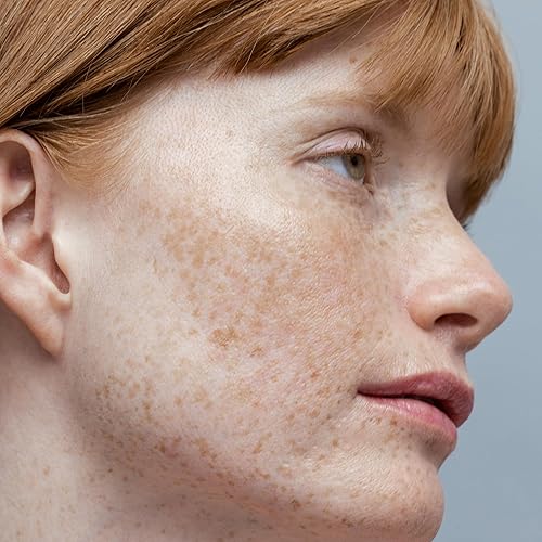 Miniatura 7 de Obagi Nu-Derm - Tónico facial sin alcohol con hamamelis y aloe vera para piel grasa o piel seca, 6.7 onzas líquidas