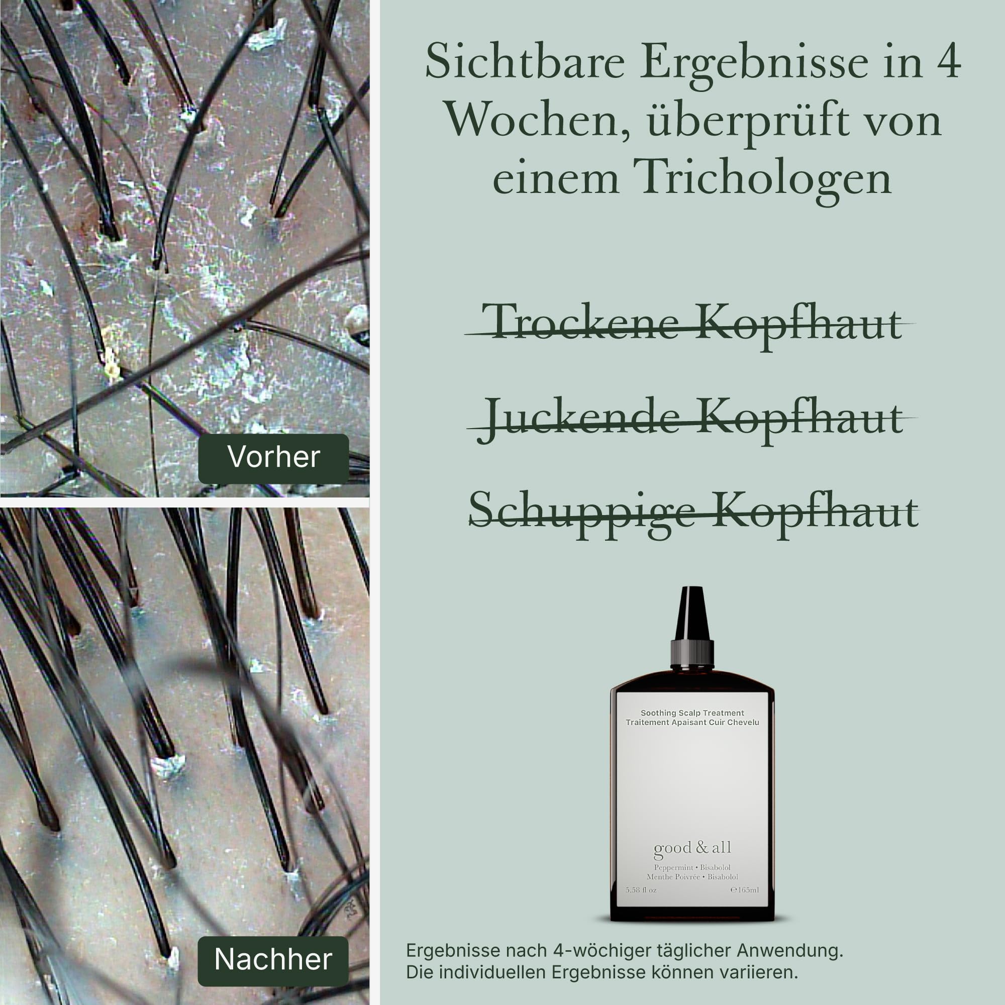 Good&All Anti-Schuppen Kopfhaut Tonikum für Trockene, Juckende Kopfhaut - Leave-in mit Pfefferminze, Bisabolol - Vegan, ohne Parfum, Parabenfrei - 165ml