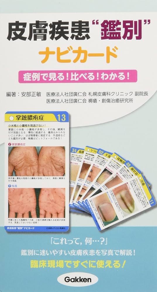 皮膚疾患鑑別ナビカード~症例で見る! 比べる! わかる! ~ ([実