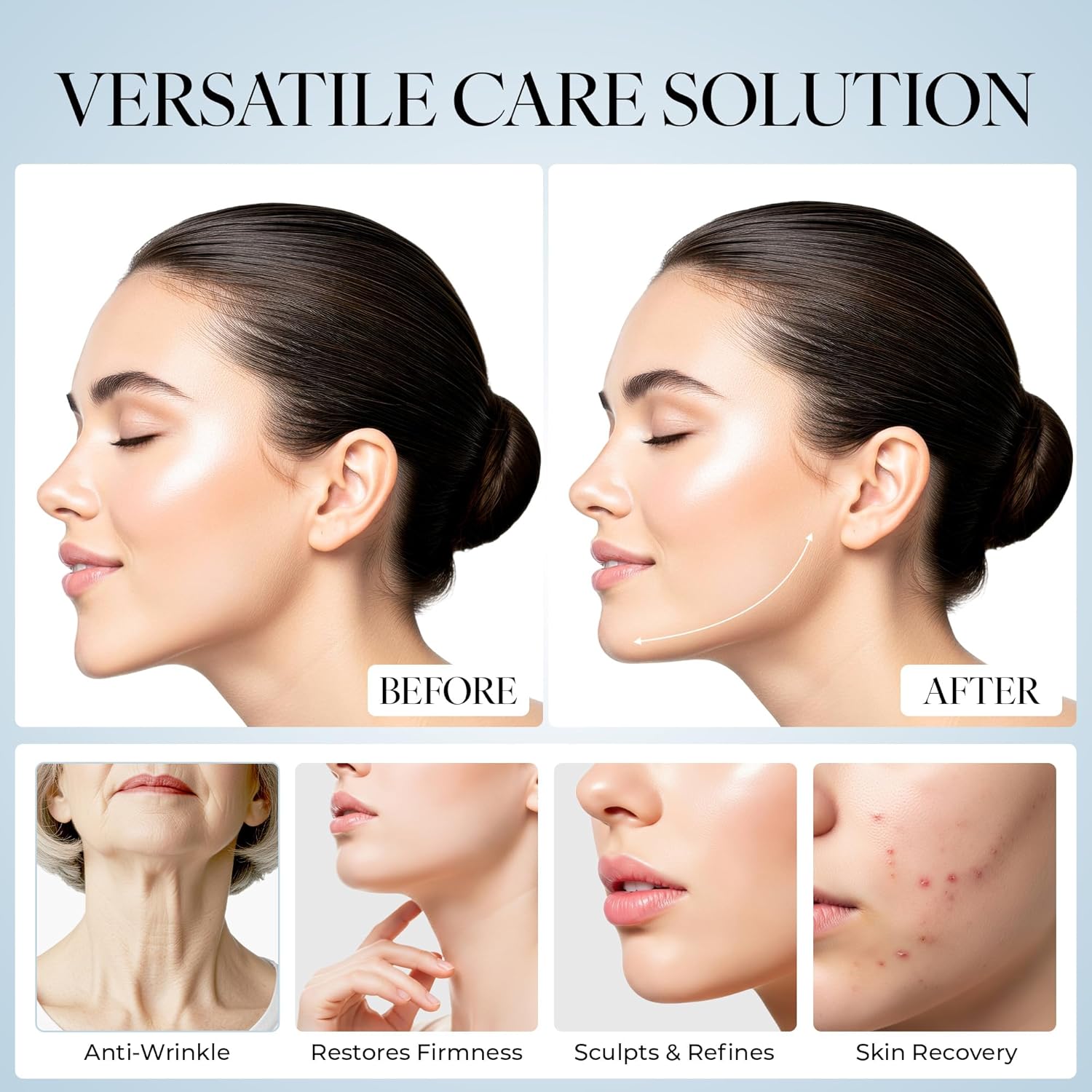 Chin Strap for Sleeping – Anti Snoring Solution for Mouth Breathers, Adjustable & Comfortable Sleep Aid for Men & Women, CPAP Users, Breathable Snore Stopper Strap – Soft & Secure Fit - Image 3