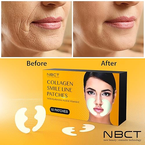 Miniatura 5 de NBCT Smile Line - Parches antiarrugas con aloe vera, ácido hialurónico y vitamina E, seguro para la piel y alternativa de botox