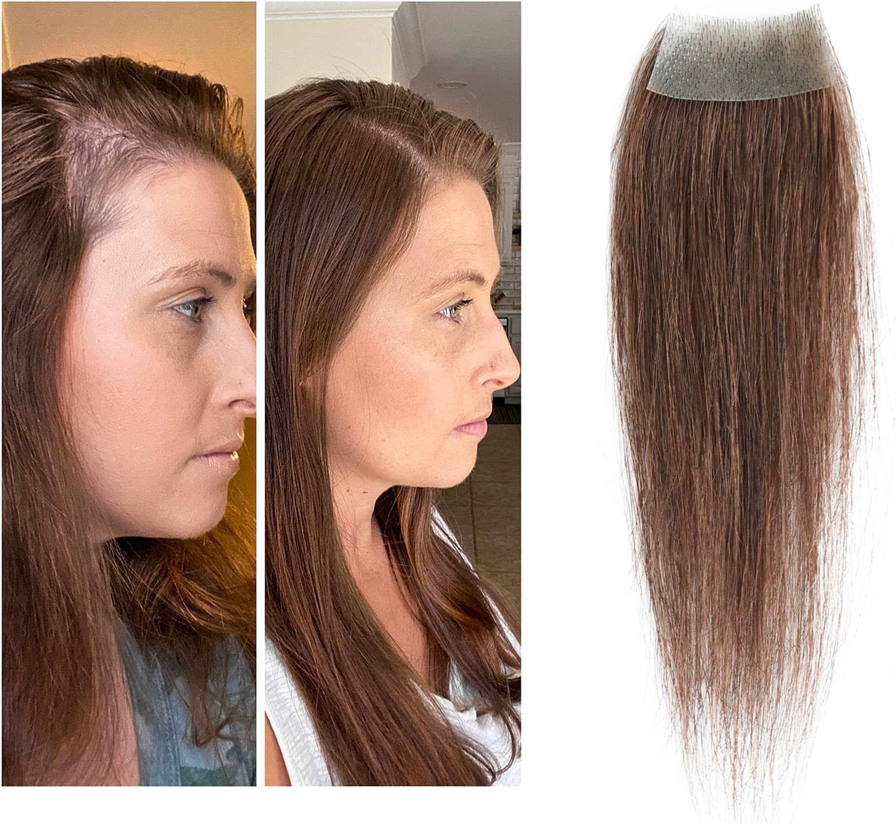 scar human hair replacement Accidental burns without hair for men women Hairline Loss Straight Tape in Replacement Toupee (Medium Brown, 0.78"x1.5")