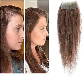 Hair Patches For Women Picks collage image 4