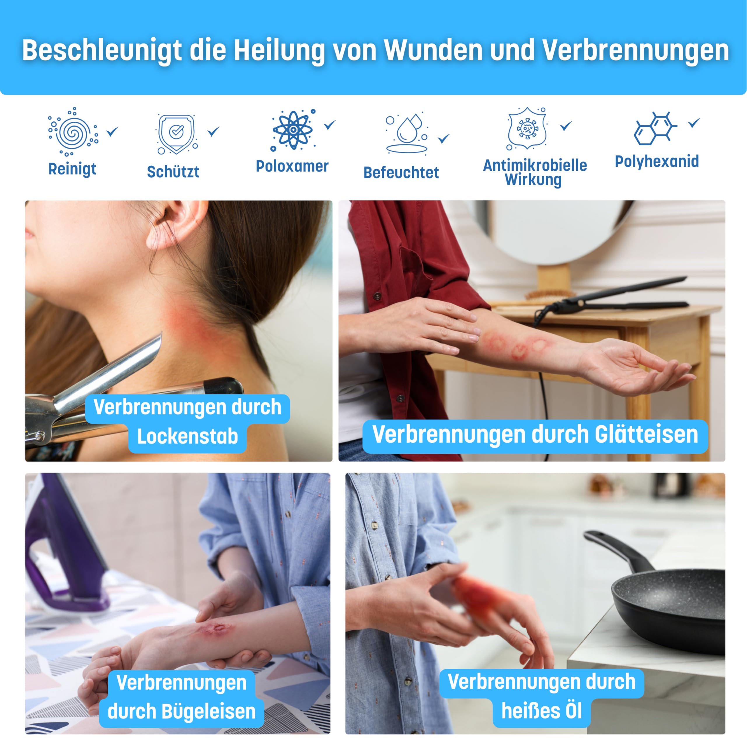 Actolind Gel Plus 250 ml – antiseptisches Wundgel für die häusliche Wundpflege | Medizinprodukt CE III | PZN 19073504