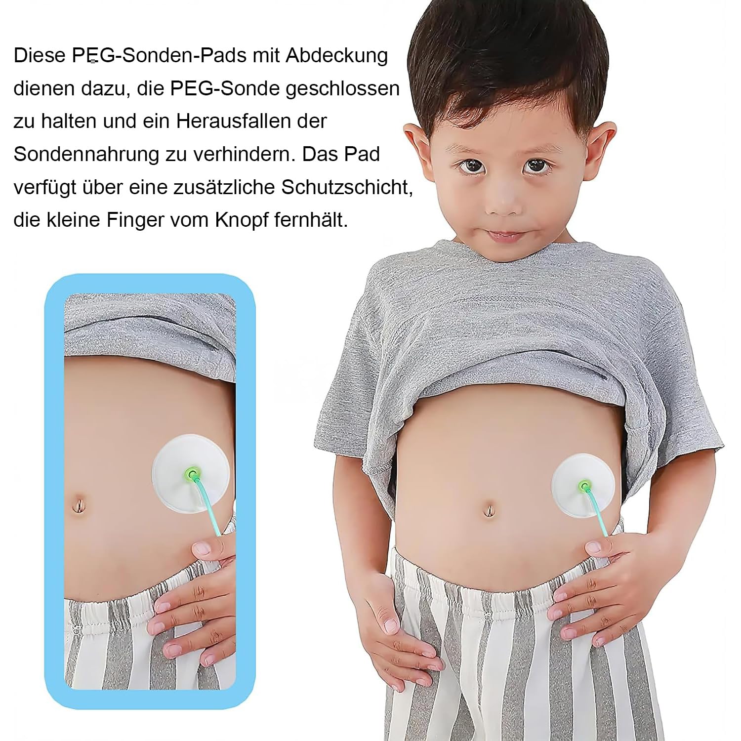 56 Stück Dialyse Schlauch Pad G-Sonden-Pad Knopfpolster aus Organischer Baumwolle, Wiederverwendbare Ernährungssonden-Zubehör zur Bauchdialyse schlauch Pad, 7,6 x 7,6 cm