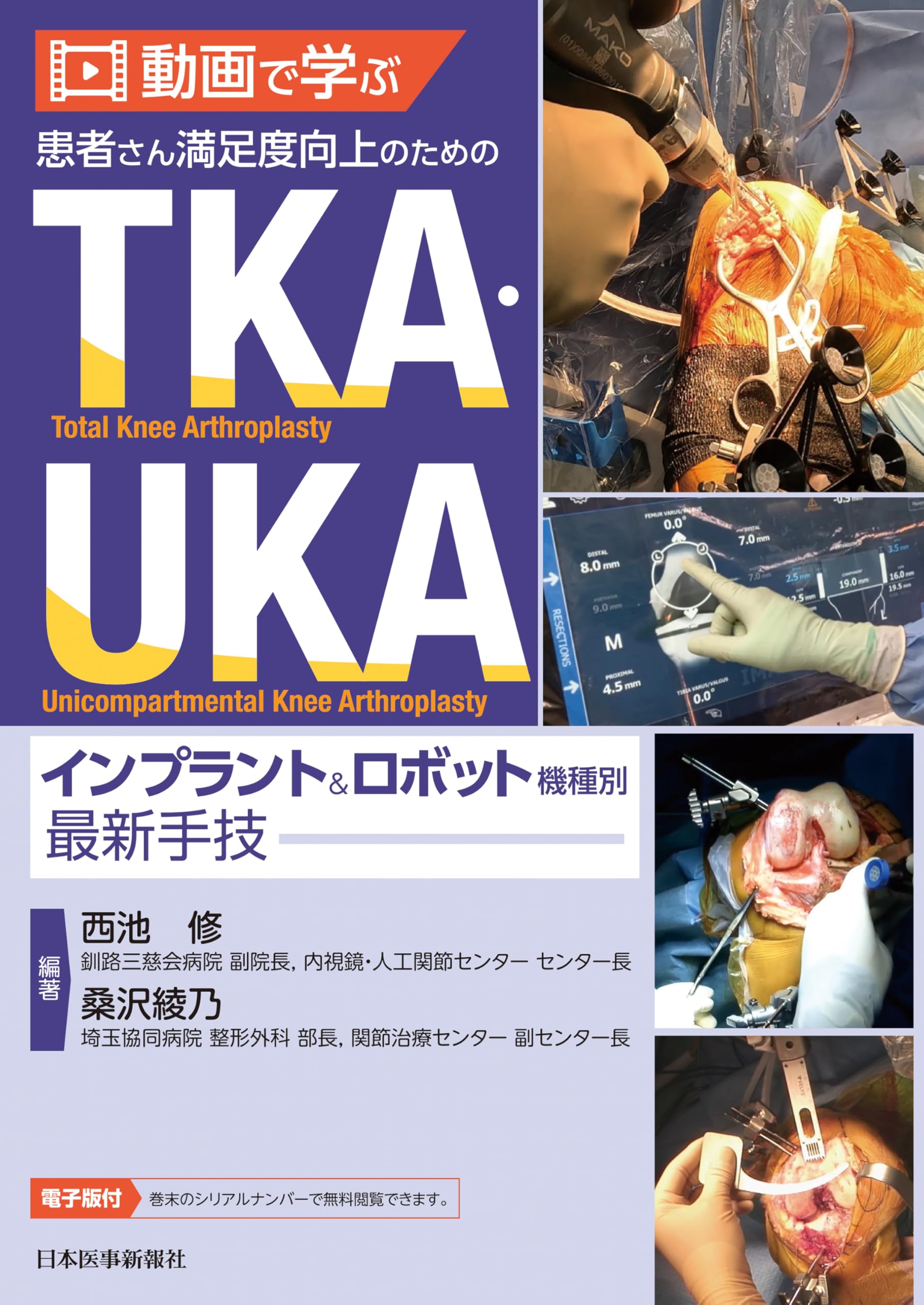 動画で学ぶ 患者さん満足度向上のためのTKA・UKA インプラント