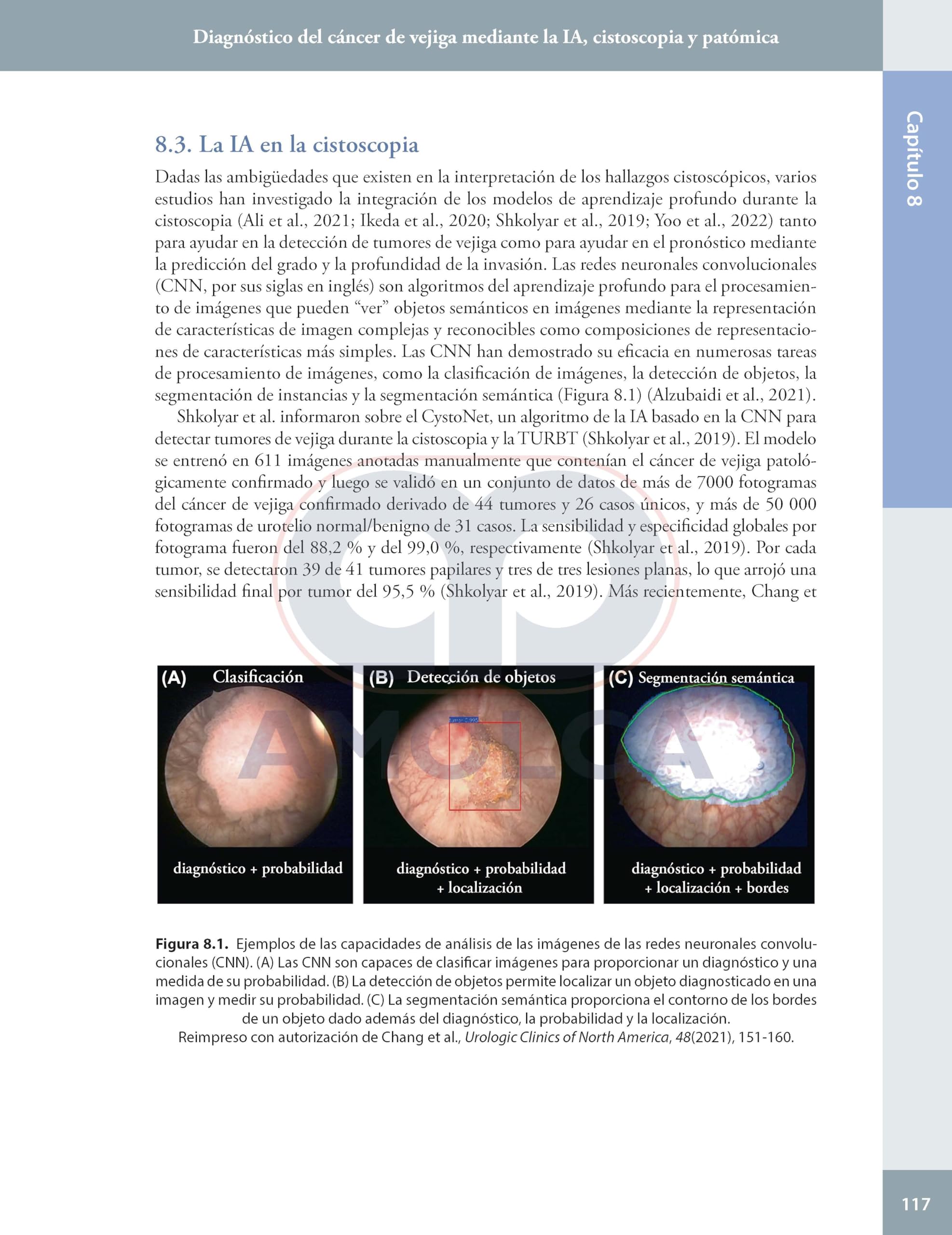 Inteligencia artificial en urologia presente y futuro
