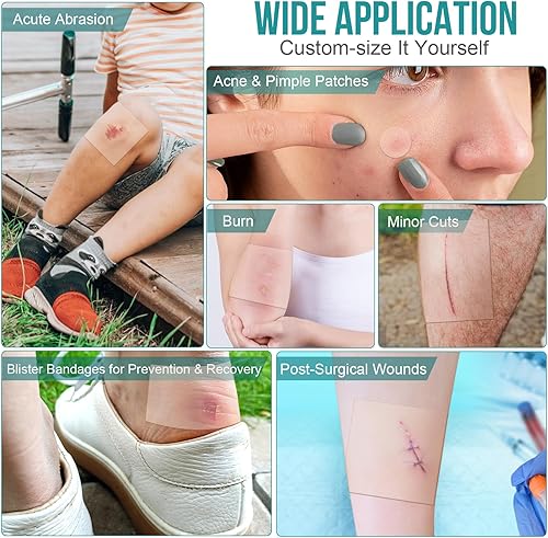 Miniatura 4 de Paquete de 40 apósitos hidrocoloides para heridas de 4" x 4", parches de vendaje hidrocoloide con autoadhesivo, vendajes para úlceras por presión,