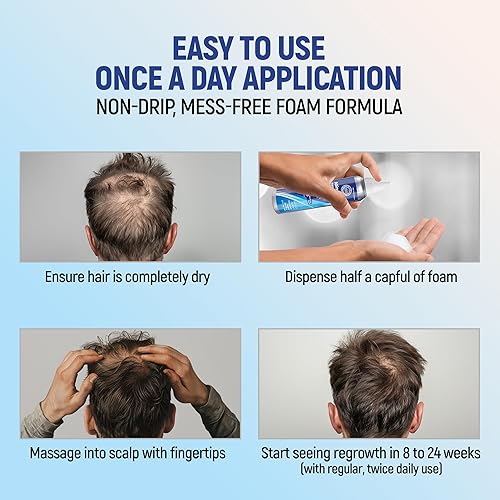 Miniatura 4 de Taro Minoxidil - Espuma en aerosol tópica, 5%, regeneración del cabello 4 meses, tratamiento para hombres, 2.11 onzas (paquete de 4)