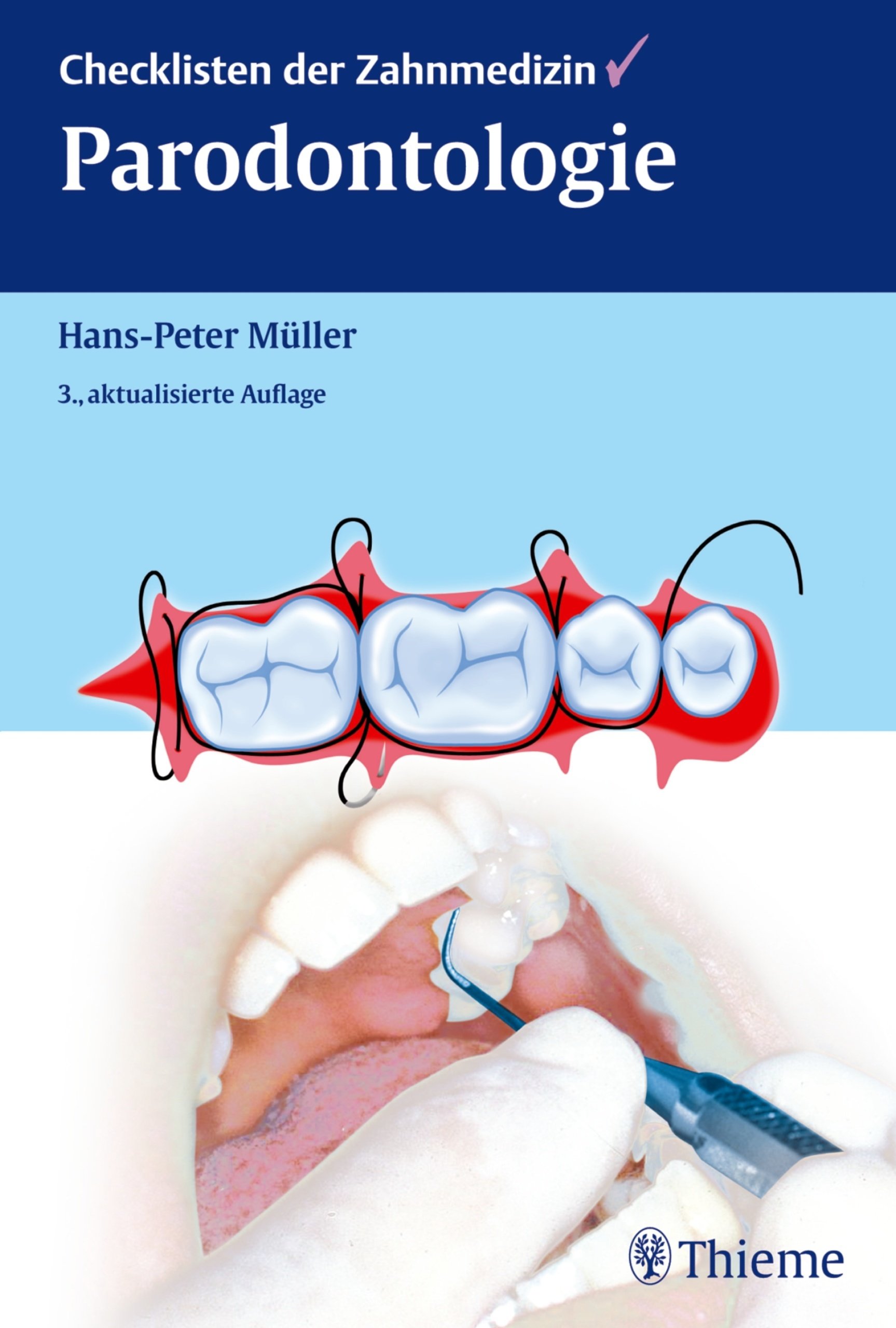 Checklisten der Zahnmedizin Parodontologie (Checklisten Zahnmedizin)