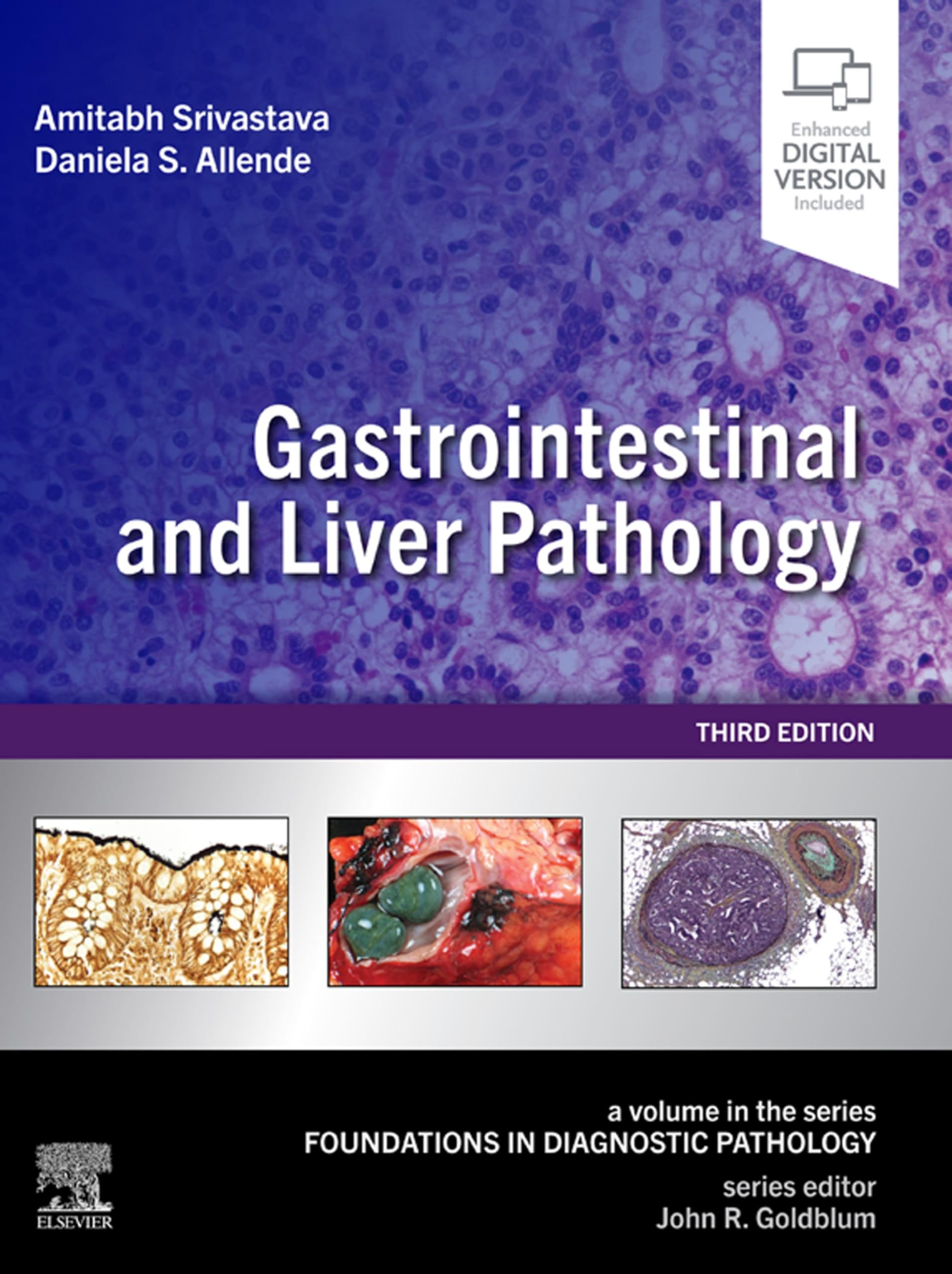 Gastrointestinal and Liver Pathology E-Book: A Volume in the Series: Foundations in Diagnostic Pathology