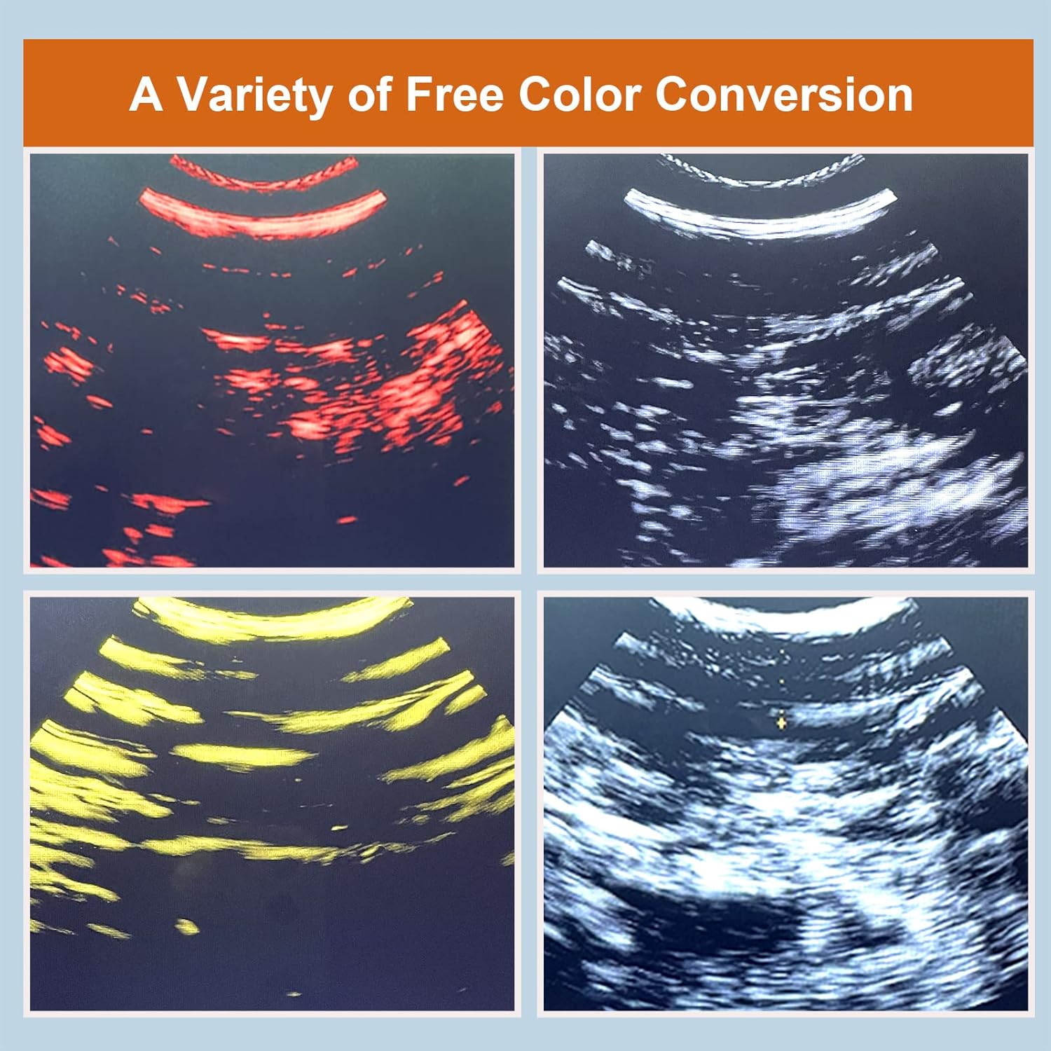 Four different color conversions of an ultrasound image