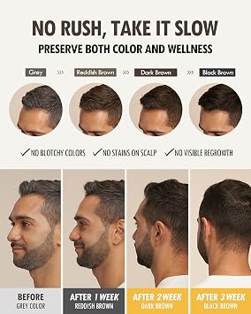 MODA MODA Zero Gray Black Hair Shampoo (10.58 Oz) | Natural Darkening Color for Hair & Scalp | Age-Defying, Volumizing Formula that Reduces Hair Breakage