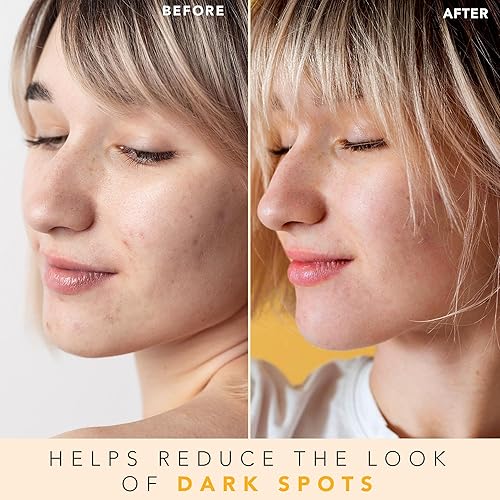 Miniatura 2 de Tóner facial con vitamina C  Spray facial tonificador facial y tonificador de piel aloe y hamamelis de bruja para spray facial tonificador facial