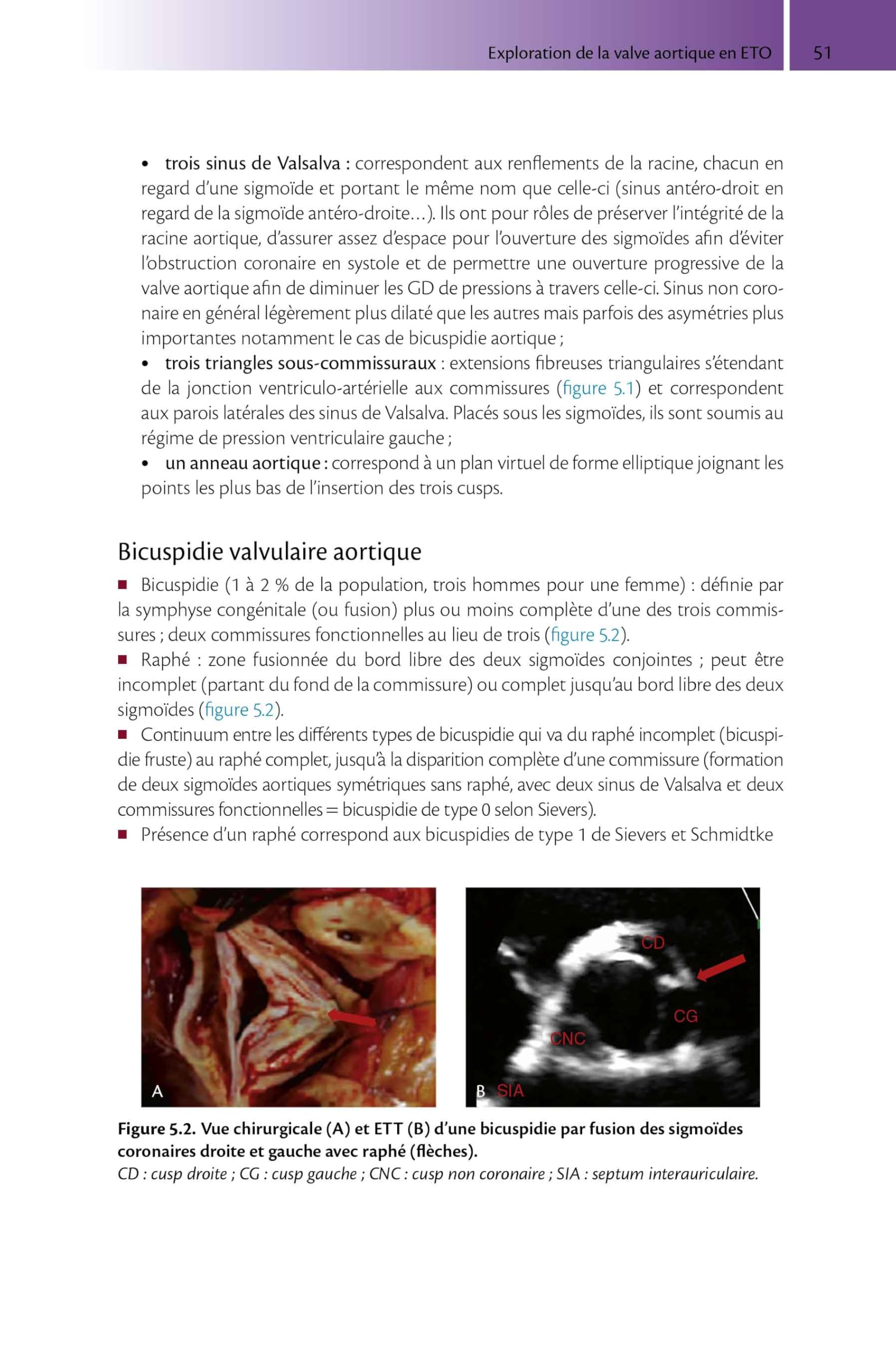Guide pratique d'échocardiographie transoesophagienne: clinique et interventionnelle