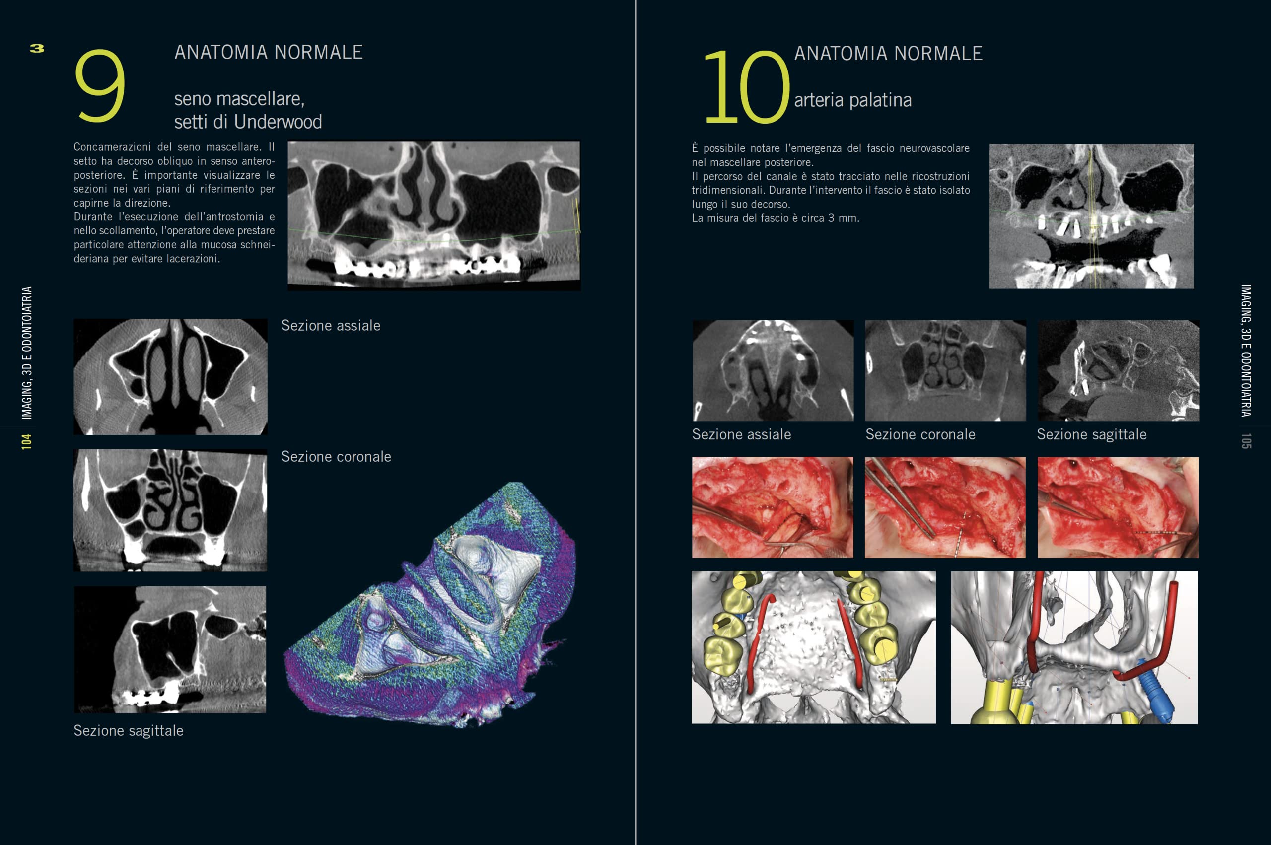 Imaging, 3D e odontoiatria. Dalla cefalometria multiplanare alla navigazione guidata in implantologia