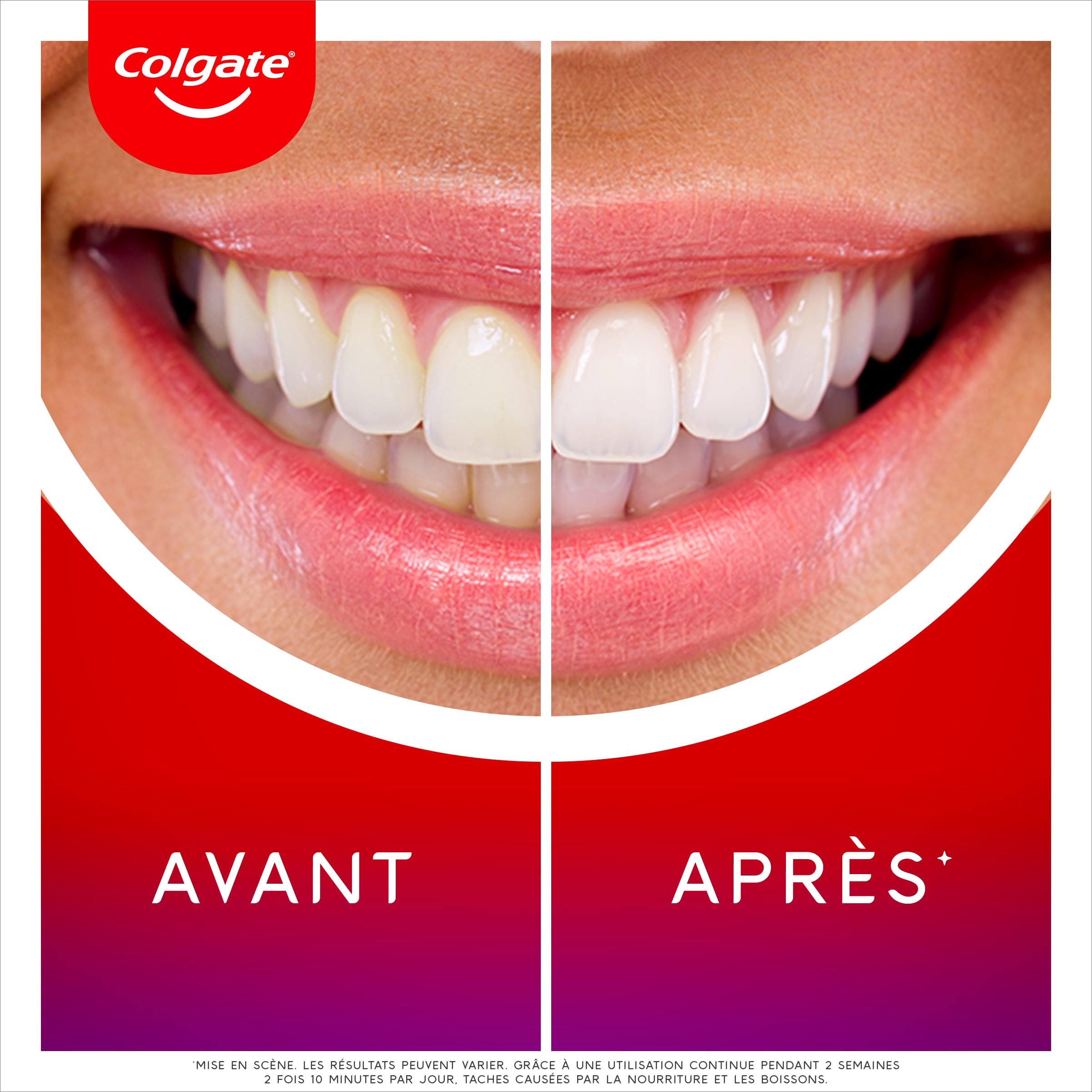 Colgate Max White Kit de blanqueamiento dental con LED - Revierte hasta 20 años de manchas* - Pack 2 sueros blanqueadores de dientes con nuevo aplicador de precisión