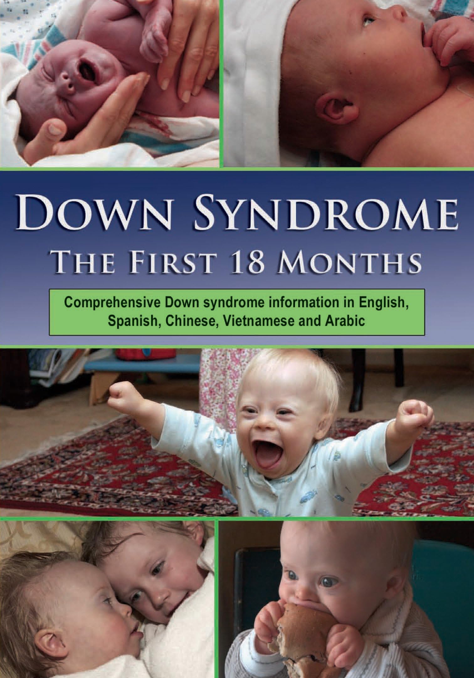 Blueberry Shoes ProductionsDown Syndrome: The First 18 Months