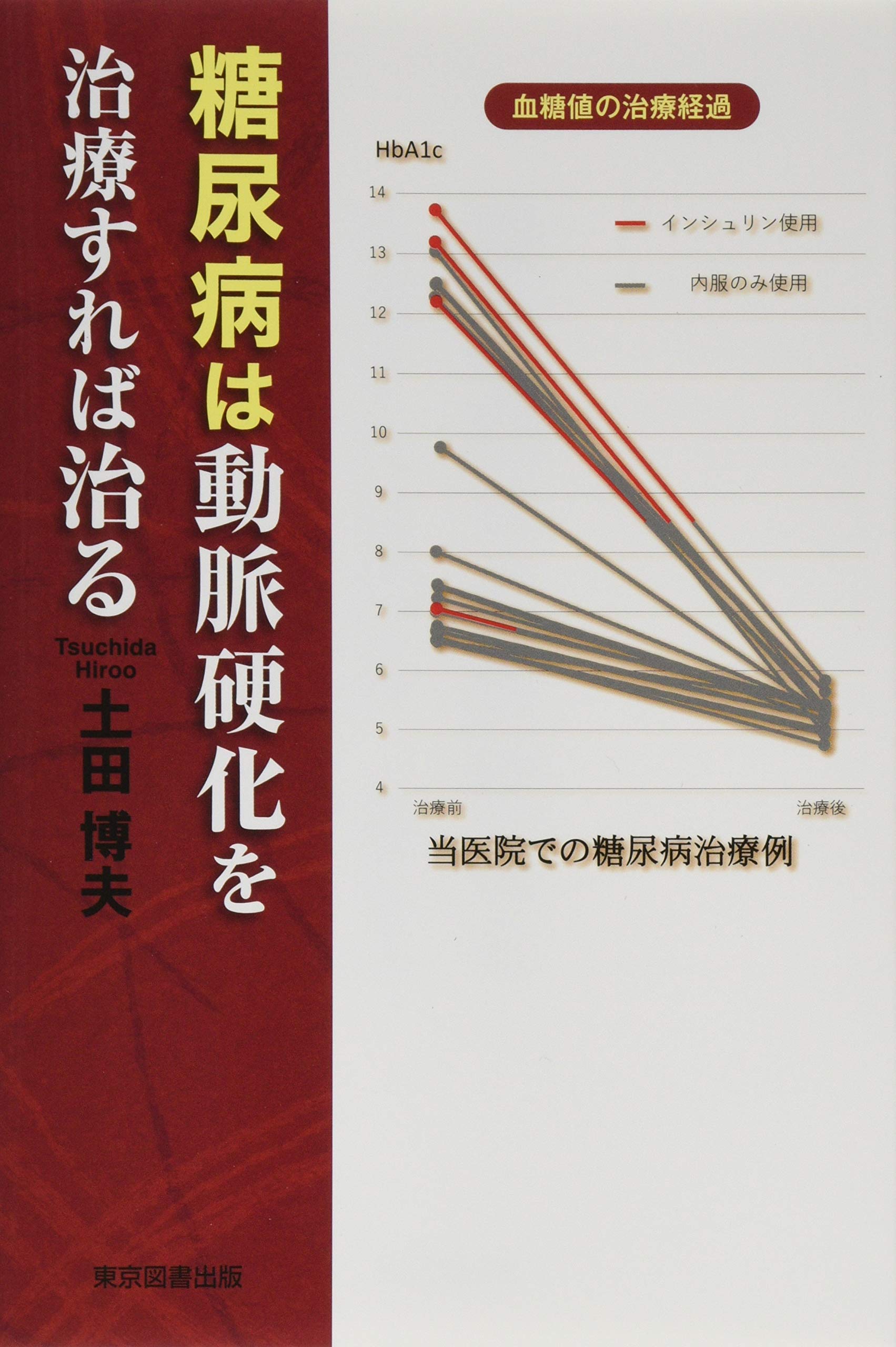 目で見る動脈硬化症/メディカルレビュ-社（単行本） Amazon.co.jp: 動脈硬化を予防する! 最新治療と正しい知識