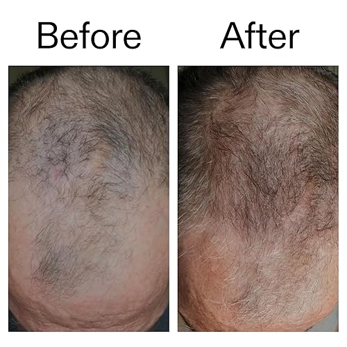 Miniatura 5 de The INKEY List Tratamiento estimulante del cuero cabelludo con cafeína, contiene redensyl y cafeína para fomentar el ciclo natural de crecimiento