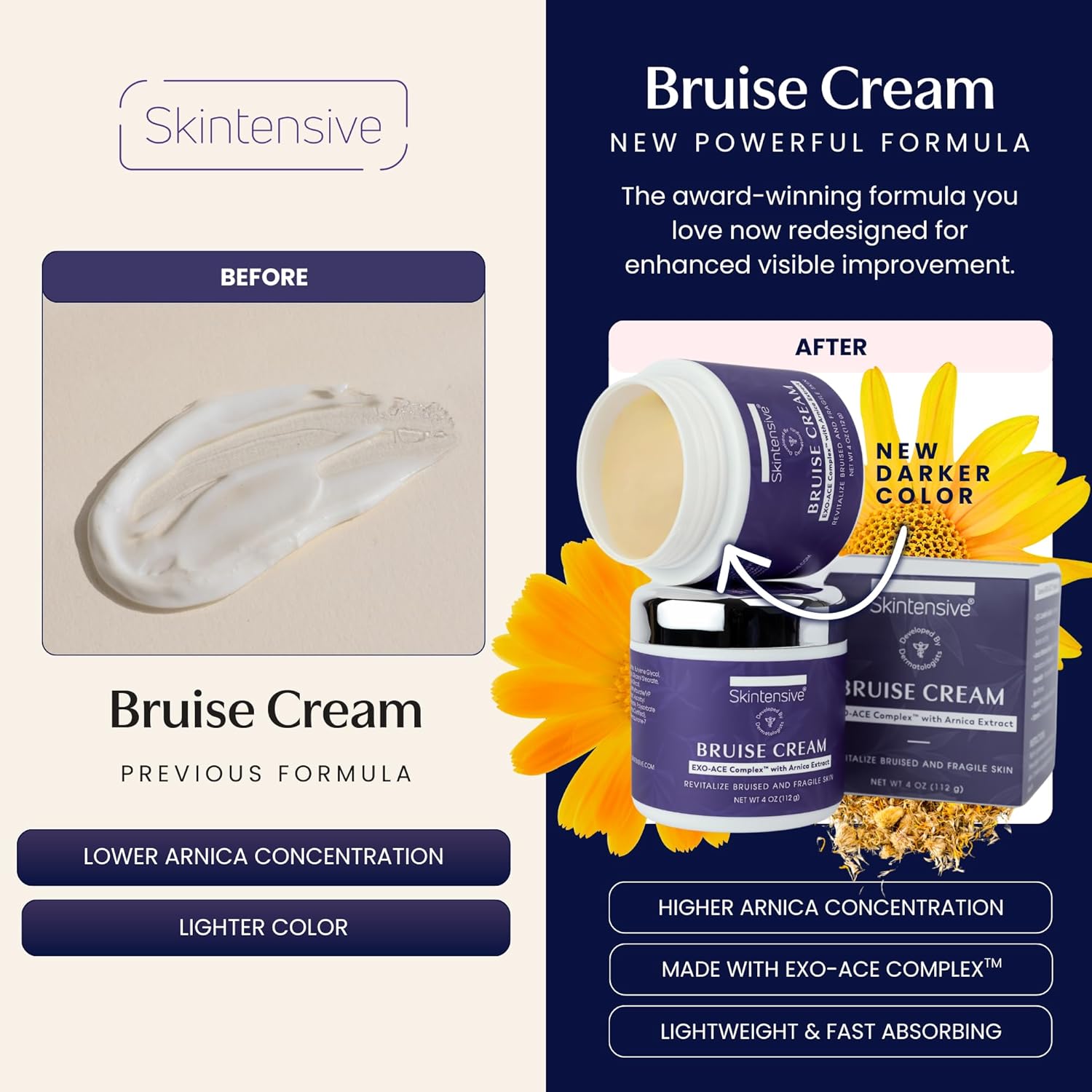 SKINTENSIVE Arnica Bruise Cream for Thin Skin - Moisturizing Arnica Cream, Vitamin K C and E, Skin Renewal, 4 Oz
