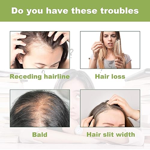 Miniatura 5 de Glammius Aceite capilar de romero con biotina para el crecimiento del cabello, 2.02 fl oz (2.0 fl oz), 100% puro y natural tanto para hombres como