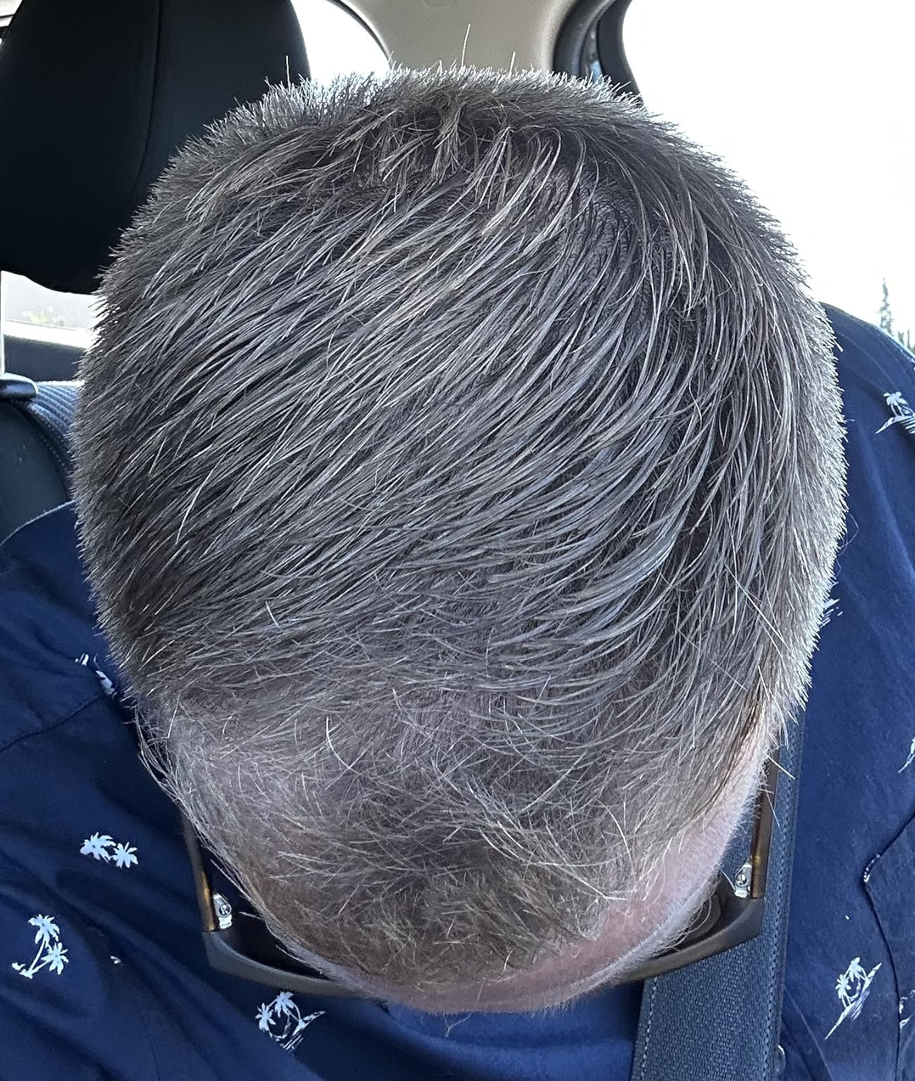 Customer photo closeup of hair texture