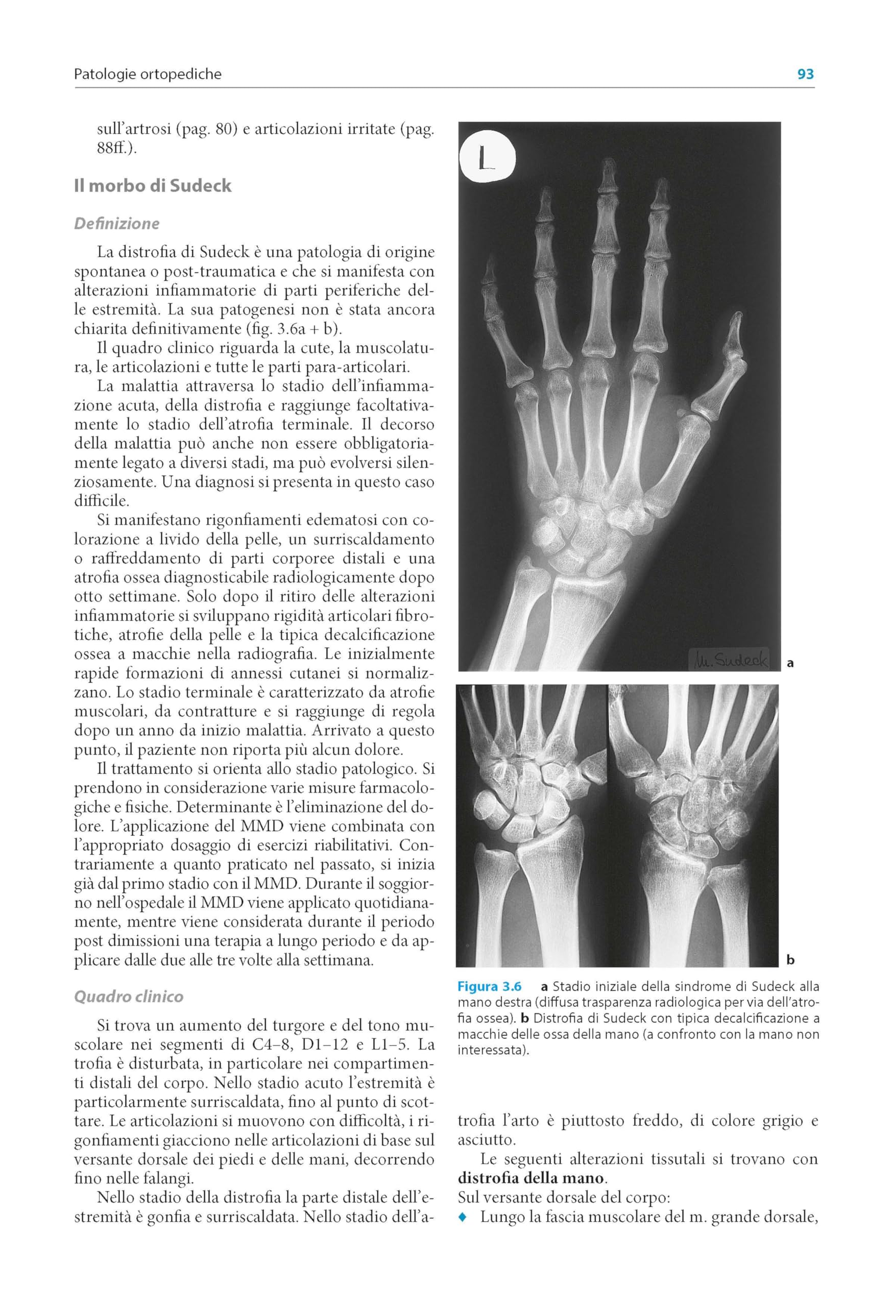 Il massaggio connettivale. Procedure neuronali, esito, prassi