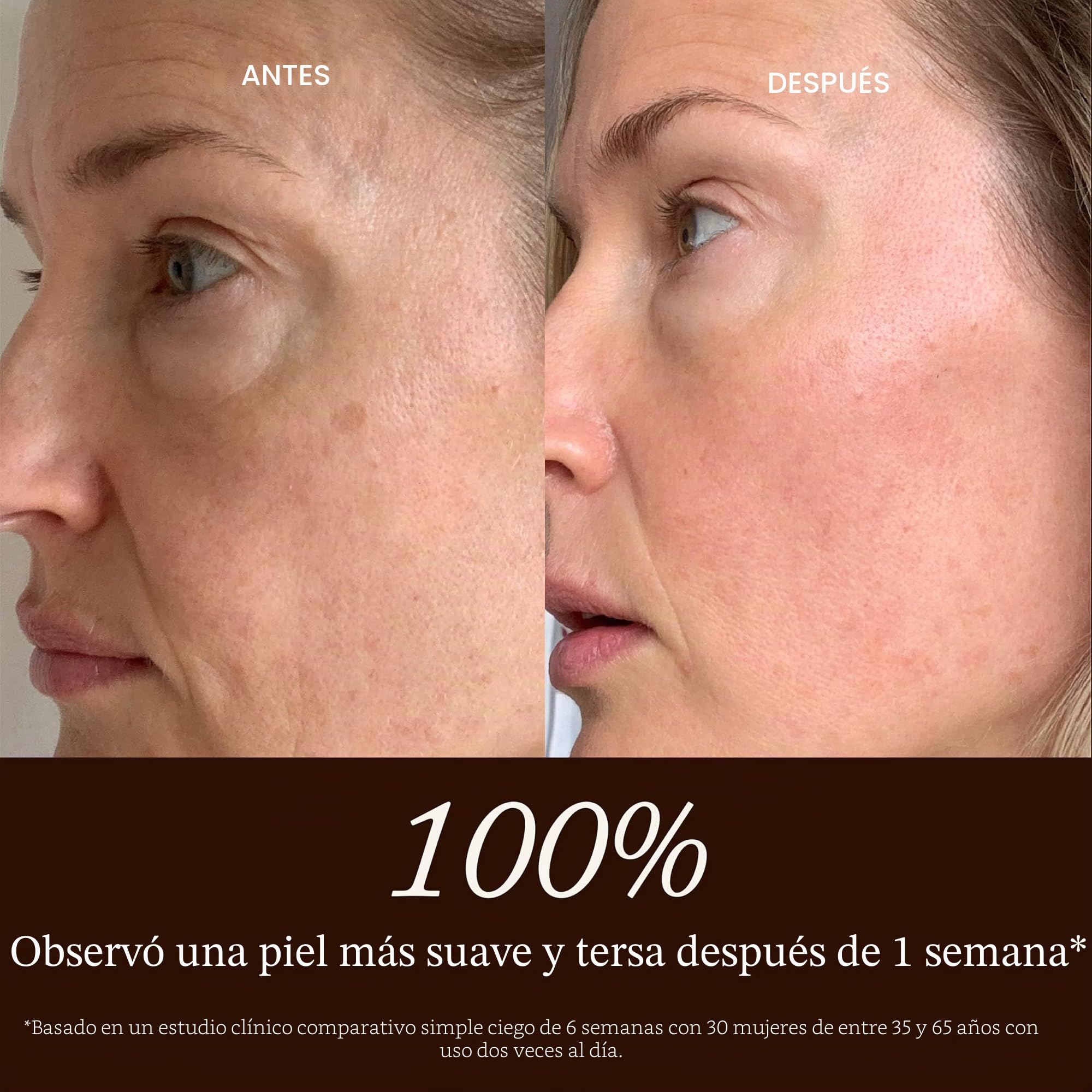 True Botanicals - Sérum natural Chebula Active | Cuidado de la piel natural, no tóxico, (30 ml)