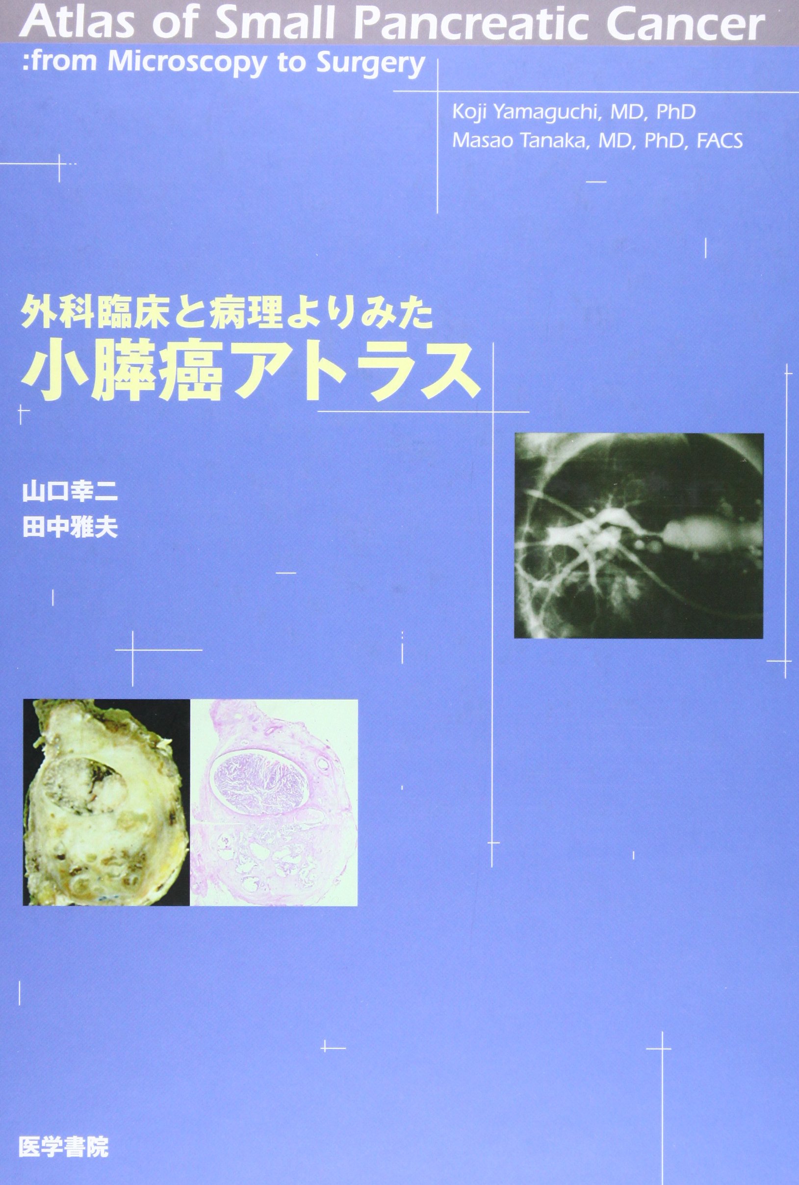 外科臨床と病理よりみた小膵癌アトラス/医学書院/山口幸二（大型本） 外科臨床と病理よりみた小膵癌アトラス |本 | 通販 | Amazon