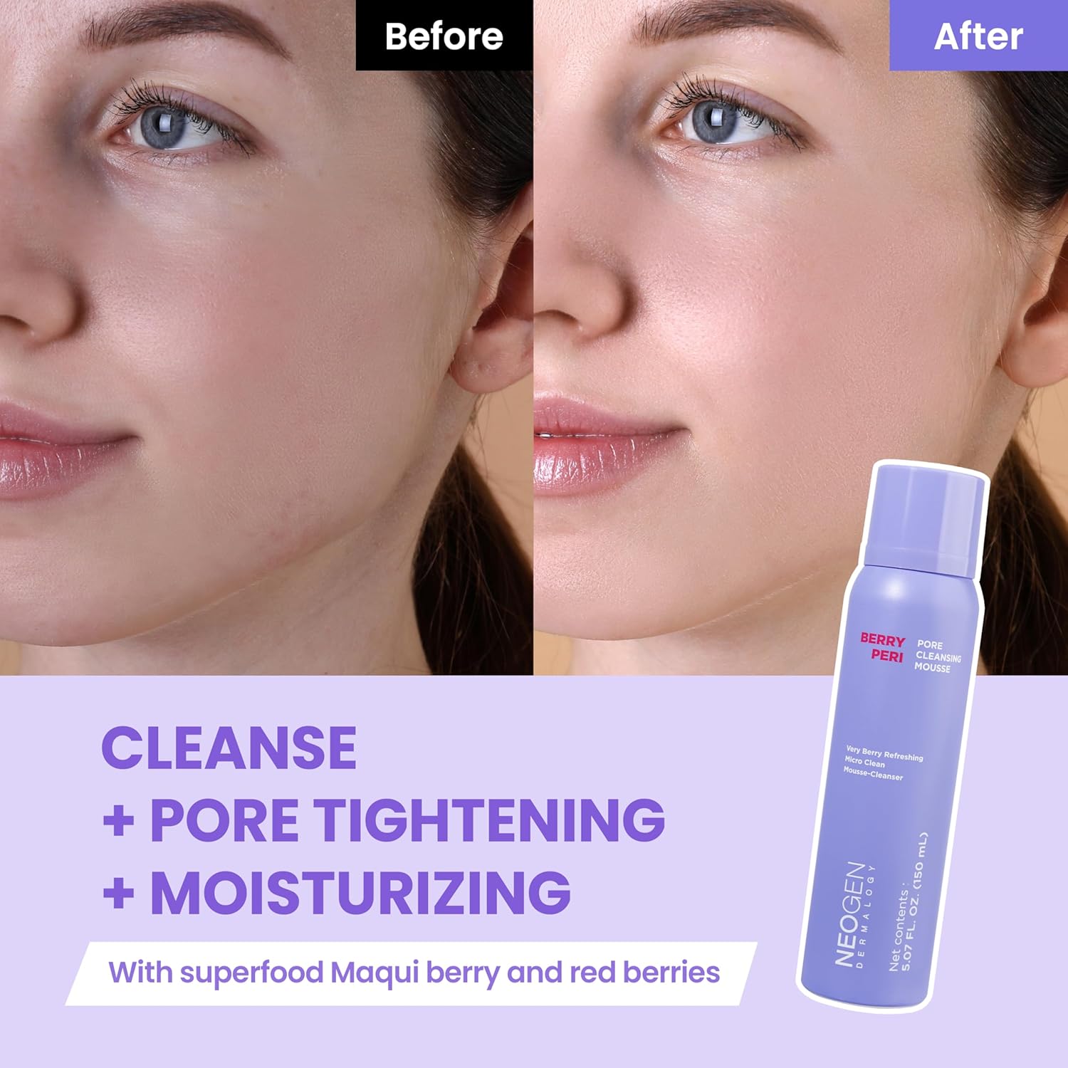 DERMALOGY by NEOGENLAB BerryPore Pore Cleansing Mousse, Deep Pore Cleanser with AHA/BHA, Removes Excess Oil & Impurities, K-Beauty Face Wash, 5.07 fl oz (150 ml) - Image 3