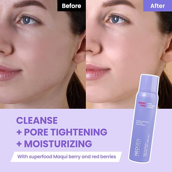 DERMALOGY by NEOGENLAB BerryPore Pore Cleansing Mousse, Deep Pore Cleanser with AHA/BHA, Removes Excess Oil & Impurities, K-Beauty Face Wash, 5.07 fl oz (150 ml)