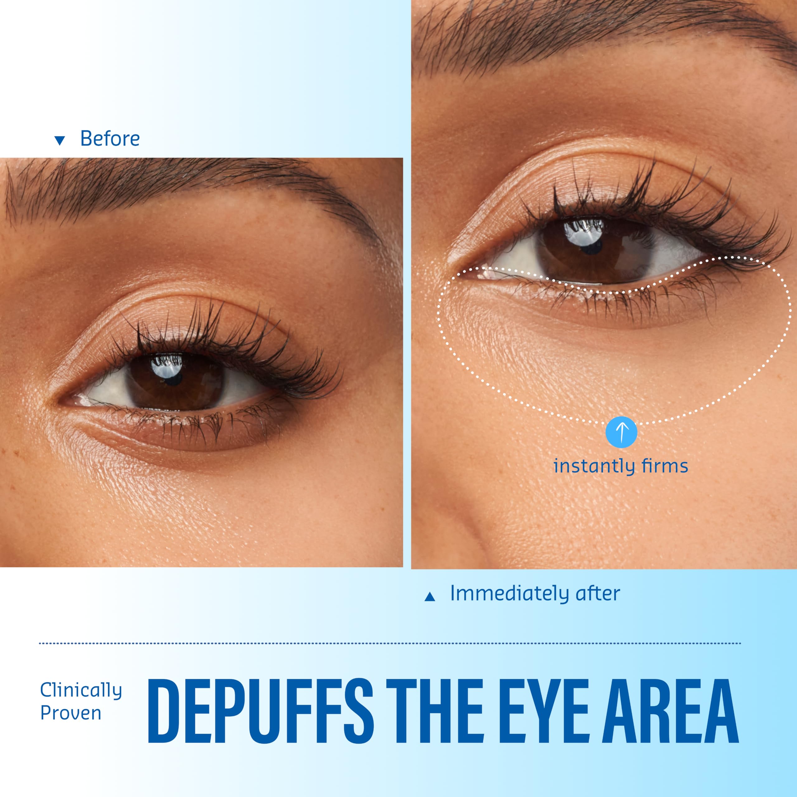 Belif Aqua Bomb Eye Gel - Reduce Puffiness & Dark Circles -4