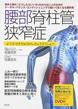 Amazon.co.jp: 腰部脊柱管狭窄症 : 安藤 邦彦, 佐藤 拓矢: 本