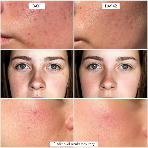 Dr. Crazy Millionaire Glow Vitamin C Serum for Face - Hydrating Glow Up Serum With Turmeric, Niacinamide, Hyaluronic Acid, Snail Mucin & Vitamin E - Fades Dark Spots & Evens Skin Tone 30ml