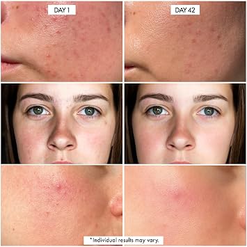Dr. Crazy Millionaire Glow Vitamin C Serum for Face - Hydrating Glow Up Serum With Turmeric, Niacinamide, Hyaluronic Acid, Snail Mucin & Vitamin E - Fades Dark Spots & Evens Skin Tone 30ml