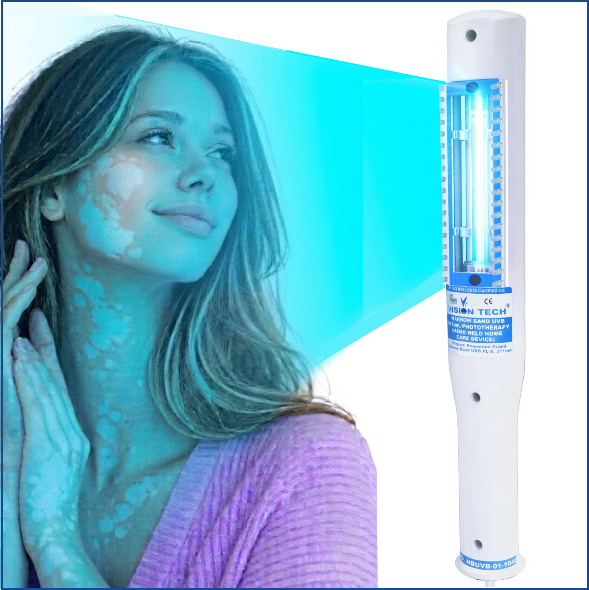VISION TECH 311nm NBUVB Handheld Phototherapy for Vitiligo + Free eBook 3