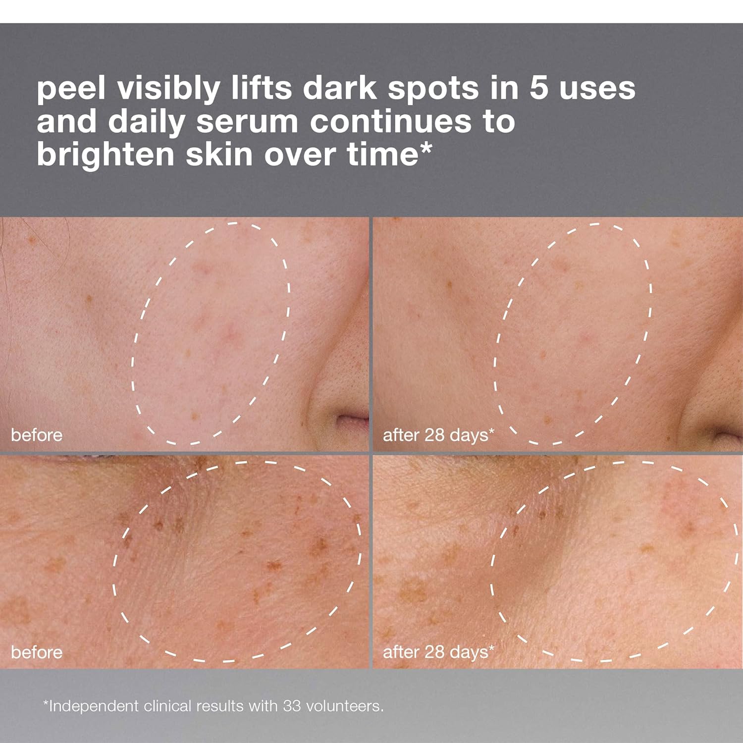 Dermalogica PowerBright Dark Spot System Skin Care Kit, Includes Face Serum and Peel - Fade, Lift, and Prevent Dark Spots and Hyperpigmentation - Image 7