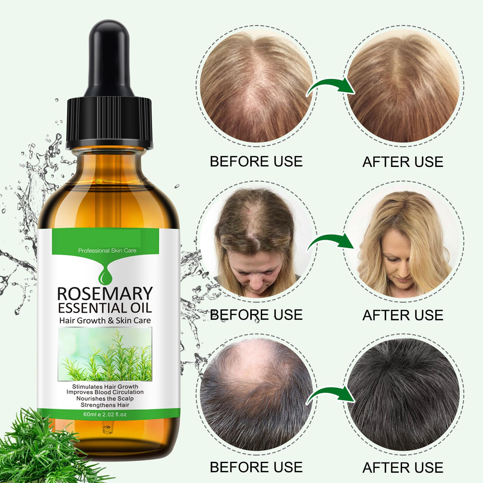 Mcukv Olio Essenziale di Rosmarino Stimola crescita Capelli,120ml, per