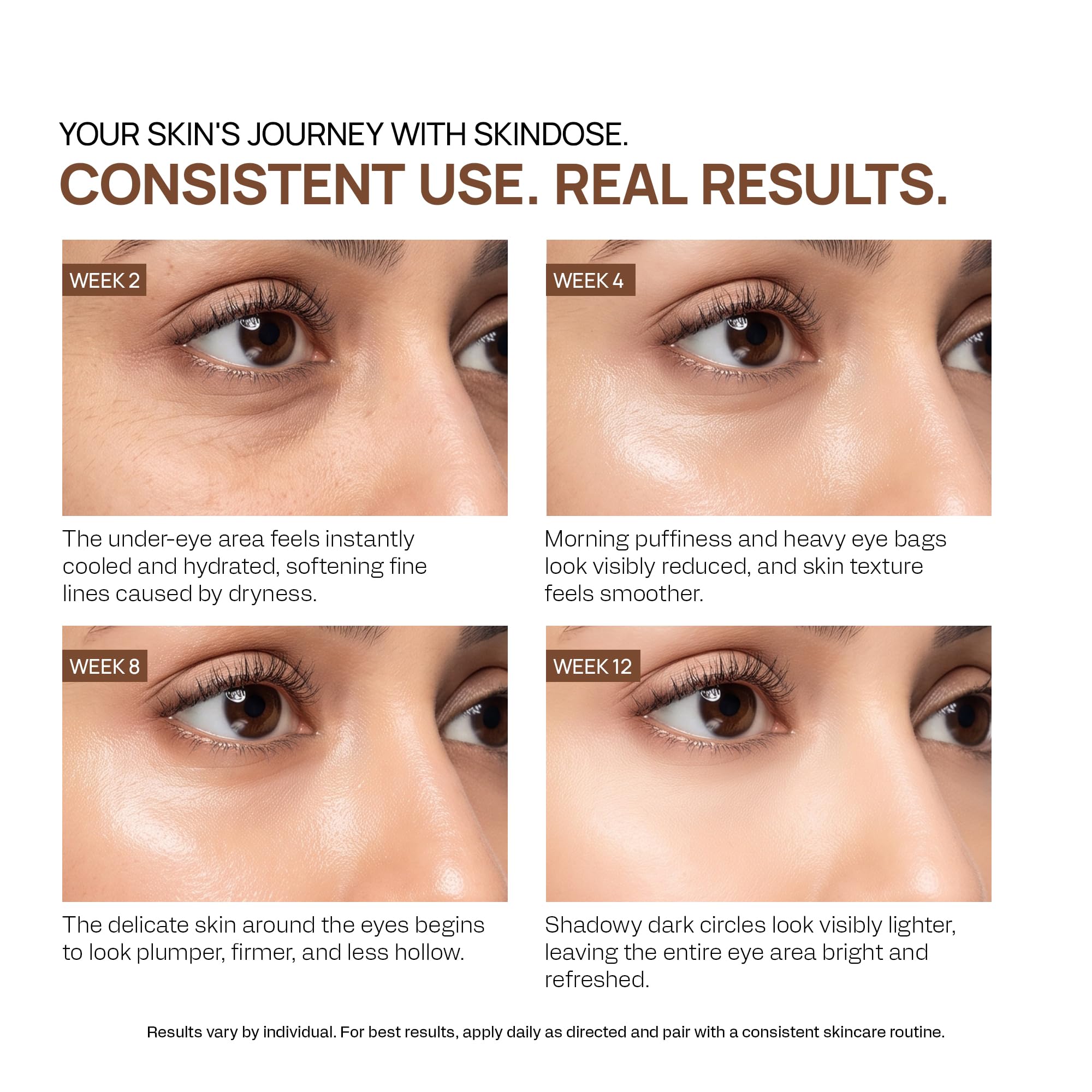 YUDERMA Yuvenex Under Eye Cream For Dark Circles – 3X Contoura Care Under Eye Gel for Dark Circle & Puffiness Treatment, Hydrating Cream for Fine Lines & Under Eye Care, 25 ml — Amazon image 4