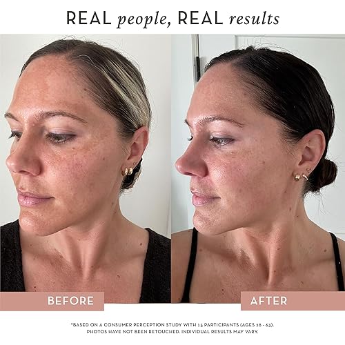 Miniatura 3 de Suero de vitamina C para la cara, fórmula todo en uno, vitamina C de grado profesional, péptidos, ácido hialurónico 3X y niacinamida, para pieles