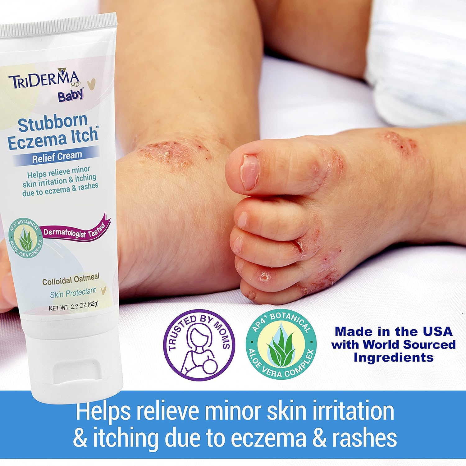 Amazon Com Triderma Baby Stubborn Eczema Itch Relief Cream Soothing For Sensitive Skin 2 2 Ounces Health Household Amazon Com Triderma Baby Stubborn Eczema Itch Relief Cream Soothing For Sensitive Skin 2 2 Ounces Health Household