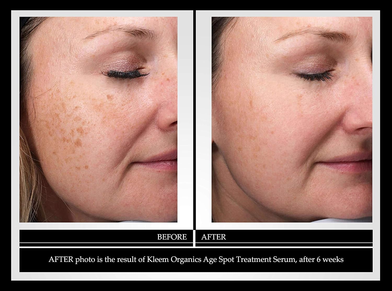 Kleem Dark Spot Corrector Serum with Vitamin C, Retinol & Hyaluronic Acid image 5
